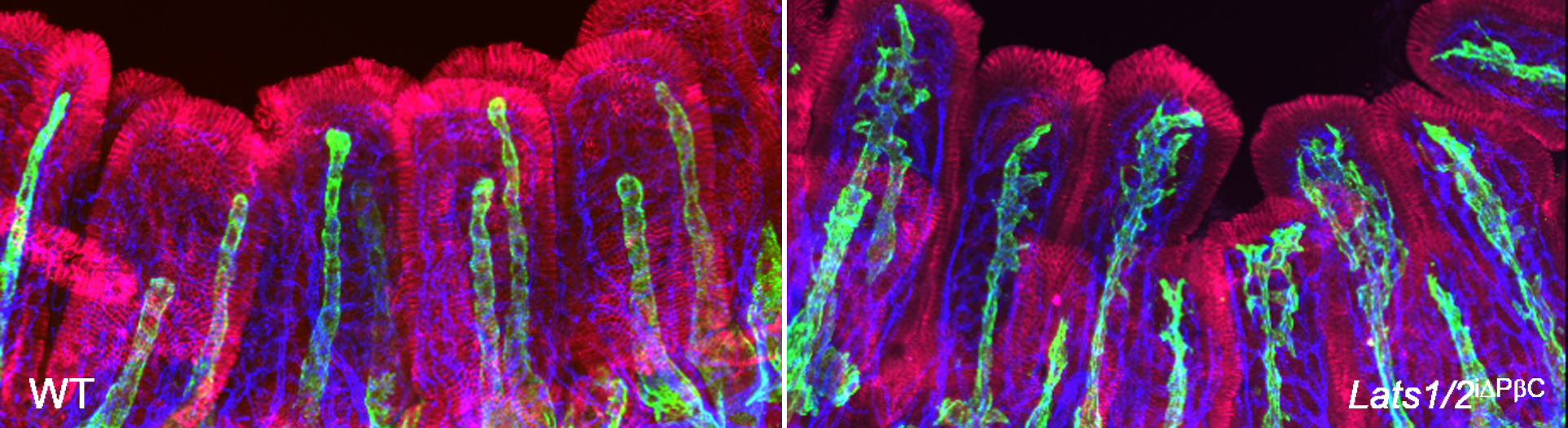 Newly identified gut cells nurture lymph capillaries