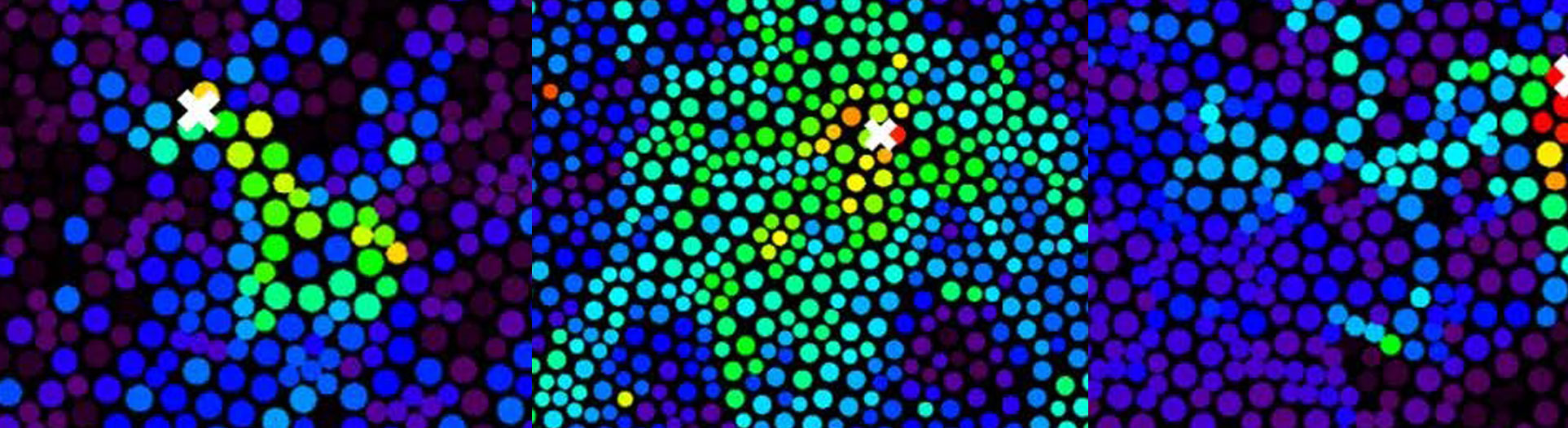 Dissecting colloidal glasses using laser as a lancet