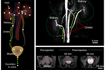 Development of MRI contrast agent for high-resolution 3D vascular mapping