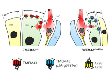 Facilitating speech comprehension in rare inherited hearing loss patients