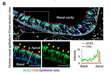 SARS-CoV-2 replication targets nasal ciliated cells early in COVID-19 infection
