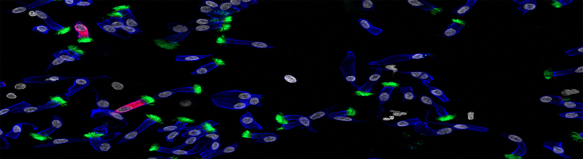 SARS-CoV-2 replication targets nasal ciliated cells early in COVID-19 infection