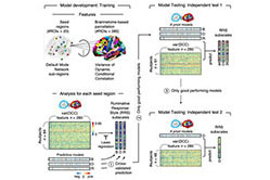 Predicting Rumination Based on Brain Connectivity