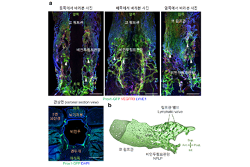 뇌 속 노폐물 청소하는 뇌척수액 배출 허브(Hub) 찾았다