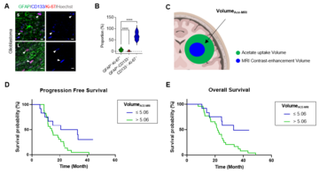 New Frontier in Glioblastoma Theragnosis - Visualizing Tumor Microenvironment