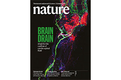 Brain Drain - Nasopharyngeal Lymphatics Found to be Crucial for Cerebrospinal Fluid Outflow
