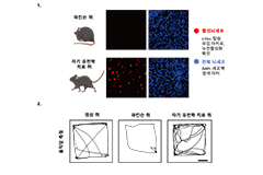 ‘자기장’ 이용해 무선으로 파킨슨병 치료한다