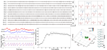 두개골에 그리는 전자회로, 뇌-컴퓨터 연결 새 지평 연다