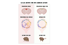 자폐스펙트럼장애, 일상의 작은 자극에도 괴로운 이유 찾았다