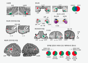 통증과 쾌락의 뇌 속 ‘교차점’ 찾았다