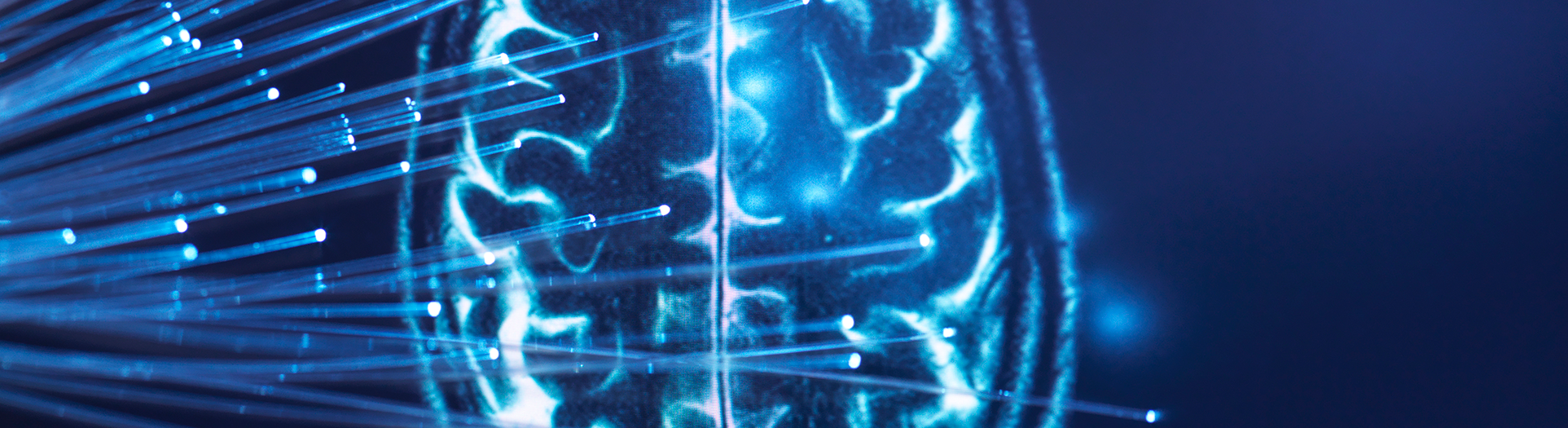 Astrocytes Identified as Hidden Culprit Behind PTSD