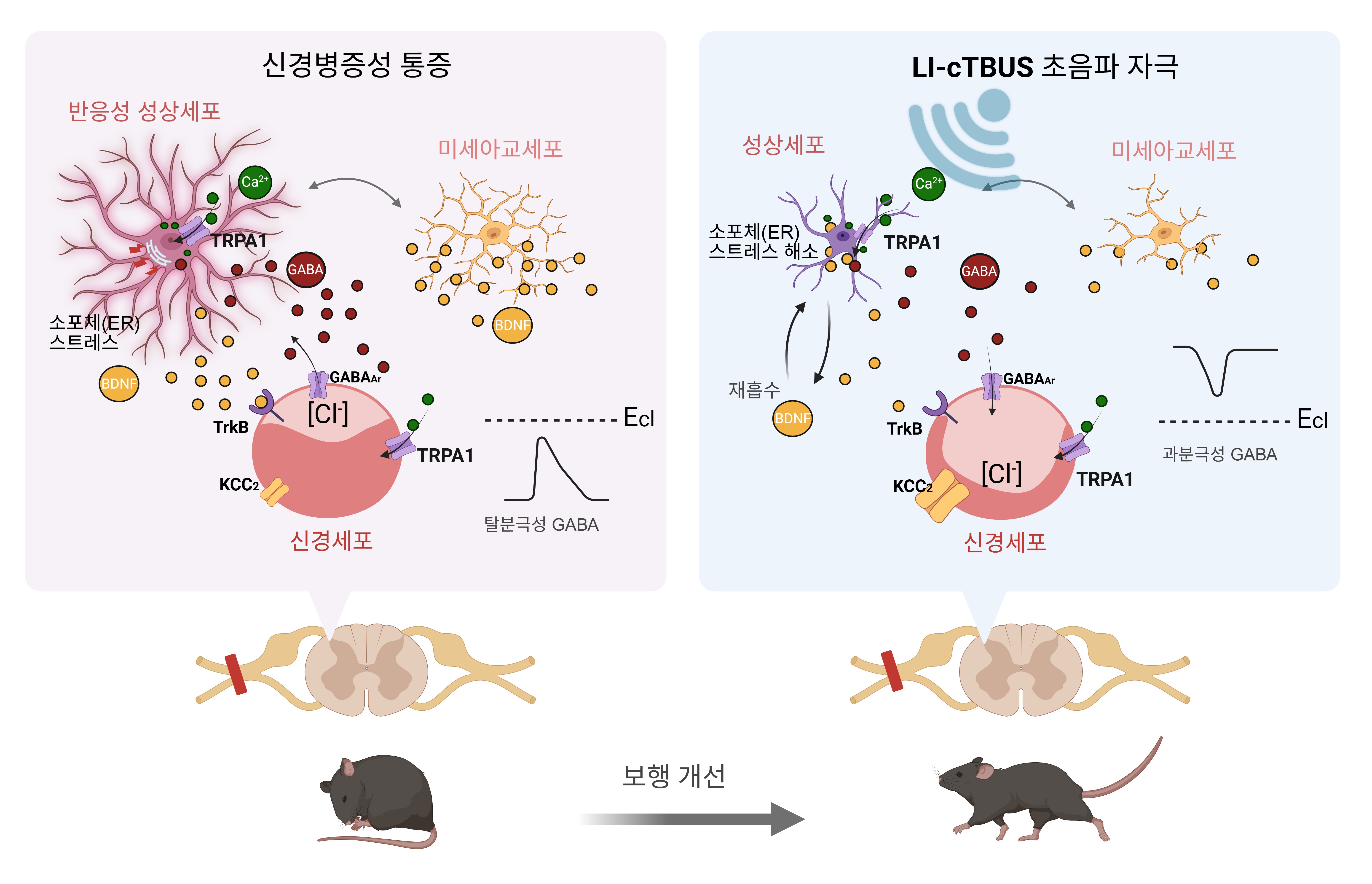 뇌파 모사한 초음파로 만성 통증 치료한다
