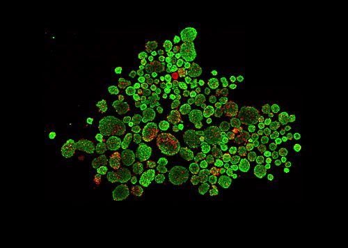 A Seoul map painted with pancreatic islets