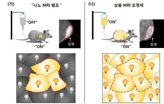 나노 MRI 램프는 꺼진 상태로 몸속에 주입돼 특정 생체인자를 만나면 켜진다. 이 때문에 상용화된 기존 MRI 조영제와 달리 질병 부위를 확연하게 구분할 수 있다.