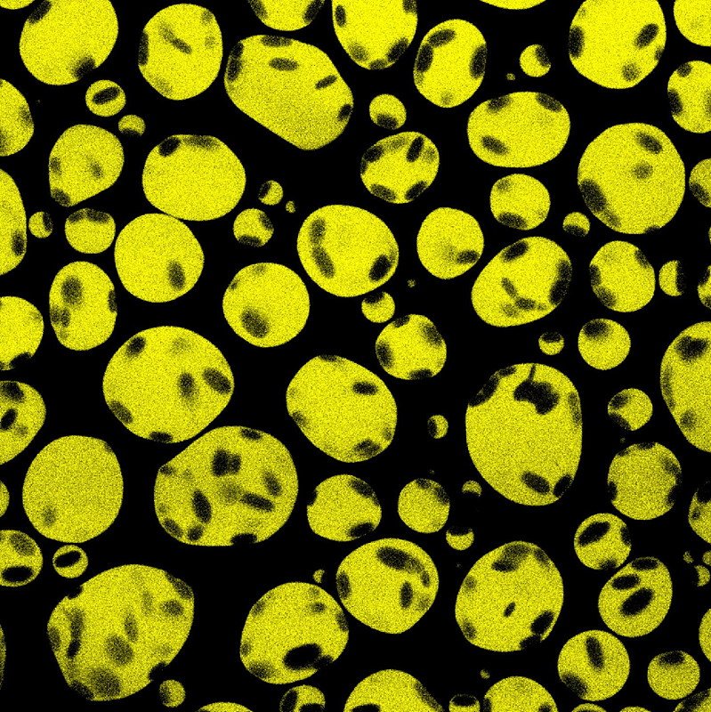 Fluorescent microscopy image of liquid-like droplets (yellow) formed of poly-L-lysine, DNA (dark spots), and adenosine triphosphate.