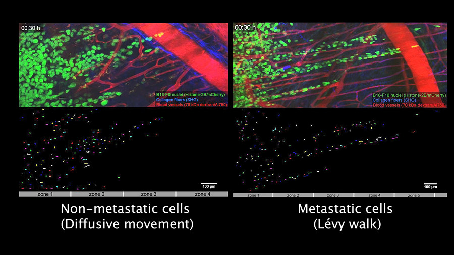 Video 2: Cell movements of non-metastatic (B16-F0, left) and metastatic (B16-F10, right) melanoma cells in the skin of a mouse.