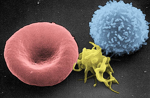 혈구의 전자현미경 사진 속 T세포(오른쪽). 가슴샘(Thymus)에서 성숙되기 때문에 첫 자를 따서 T세포라는 이름이 붙었다. (사진 : 위키백과)