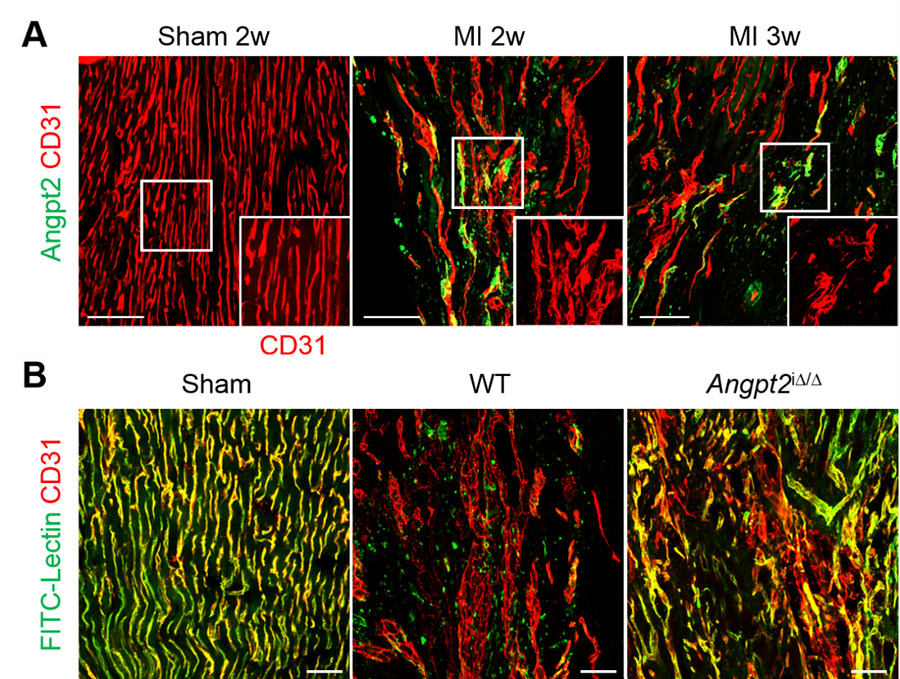 ▲ angpt2 발현을 억제한 생쥐에서 심근경색을 유발시키고 2주 후 허혈성 경계 지역을 관찰했다. 그 결과 혈관의 변형이 억제되고 혈류 흐름이 개선된 것을 확인하였다.