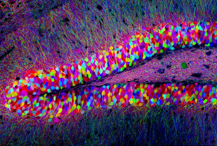 브레인보우 기술로 생쥐의 신경세포를 무지갯빛 숲처럼 드러냈다. (사진 :Harvard Center for Brain Science)