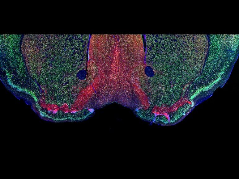 <모르피우스의 눈>, 박하람(IBS 시냅스 뇌질환 연구단), 2018 (사진: IBS)