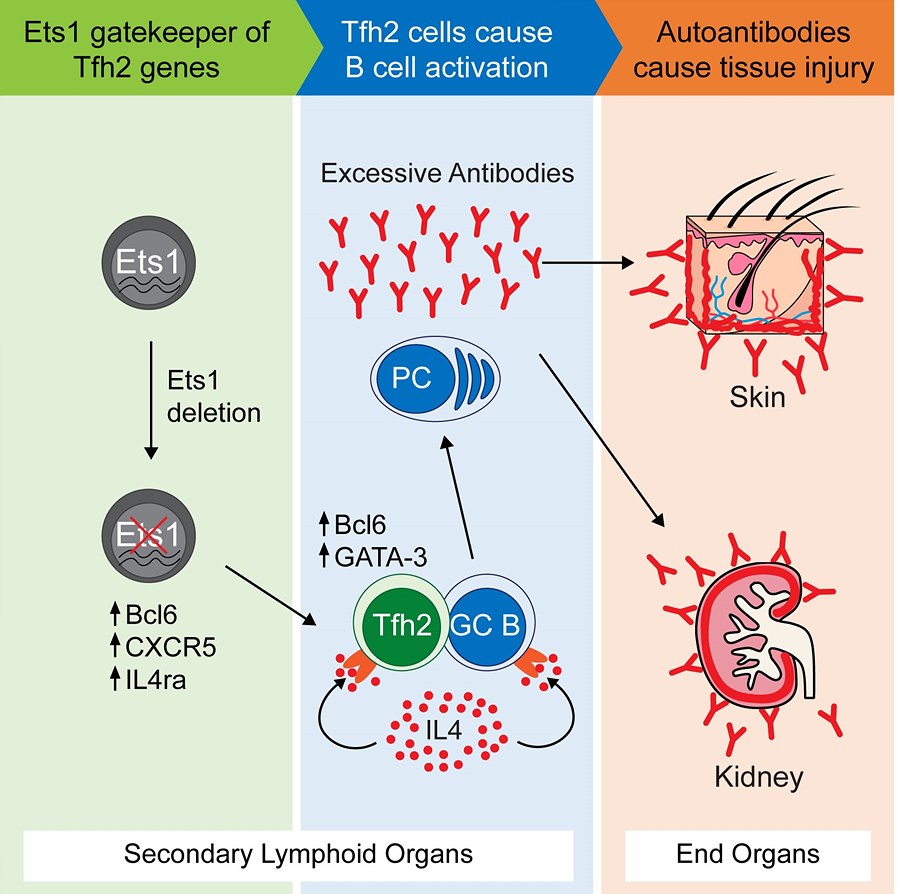 Figure 1: Lack of Ets1 gene leads to SLE.