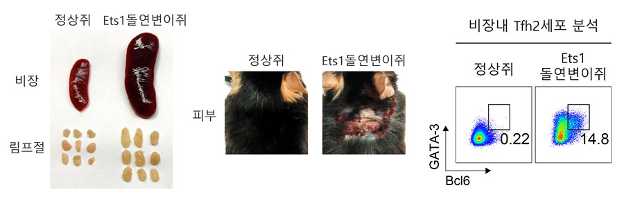 연구진은 면역세포가 결손된 생쥐들을 대상으로 실험을 한 결과, Ets1 유전자 변이가 도입된 생쥐의 경우 루푸스 환자와 비슷한 증상들이 나타남을 확인했다. 연구진은 오른쪽 그래프와 같이 Ets1 유전자 결손을 유도하면 Tfh2 세포가 증가해 루푸스가 발병한다는 사실을 확인했다. 그래프에서 보이는 것처럼 정상 쥐에서는 Tfh2 세포가 거의 존재하지 않는 반면 Ets1 유전자변이 생쥐에서는 Tfh2 세포가 상당수 존재한다. 즉, Tfh2 세포의 증가가 루푸스 증상을 유도함을 동물 실험으로 확인했다. 