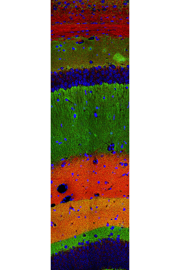 Layers Upon Layers by Yeonsoo Choi Center for Synaptic Brain Dysfunctions'