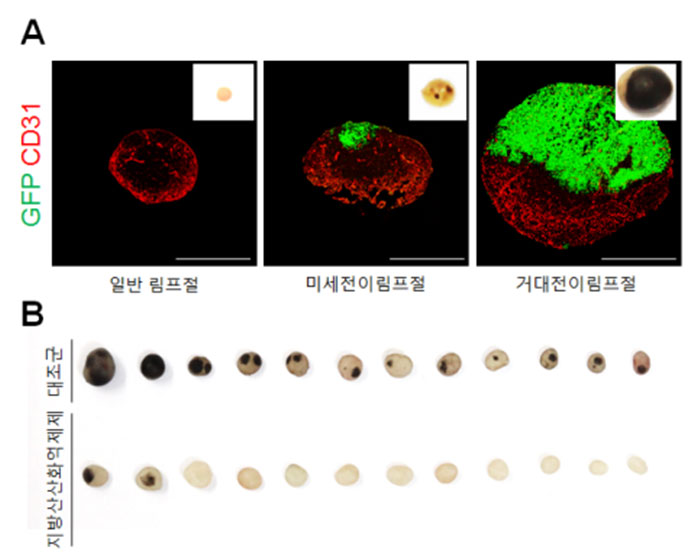 연구진은 일반 림프절에서 흑색종 암세포가 전이되는 단계별 과정(그림A)을 살펴본 결과, 와 같이 지방산 대사 관련 유전자가 전이된 림프절에서 더욱 활성화되어 있음을 확인했다. 연구진은 지방산 산화 억제제(Etomoxir)를 실험군에 투여하자 대조군에 비해 암세포의 림프절 전이(이미지 속 검은 부분인 흑색종)가 획기적으로 감소함을 확인했다(그림B).