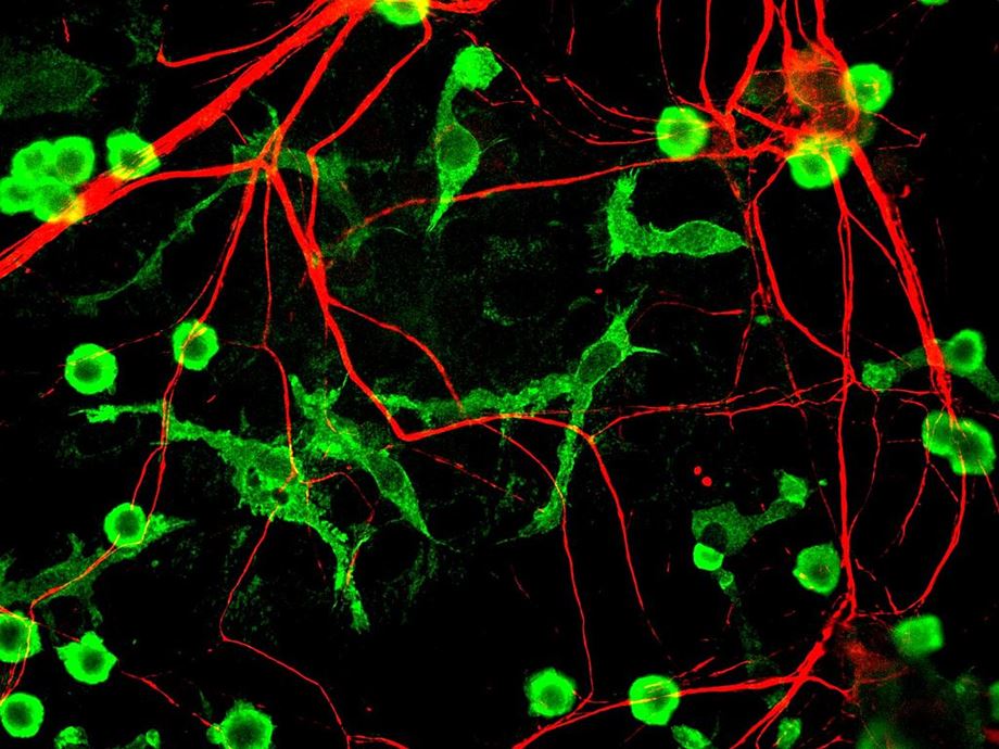 미세아교세포의 모습. (출처: Wikipedia)