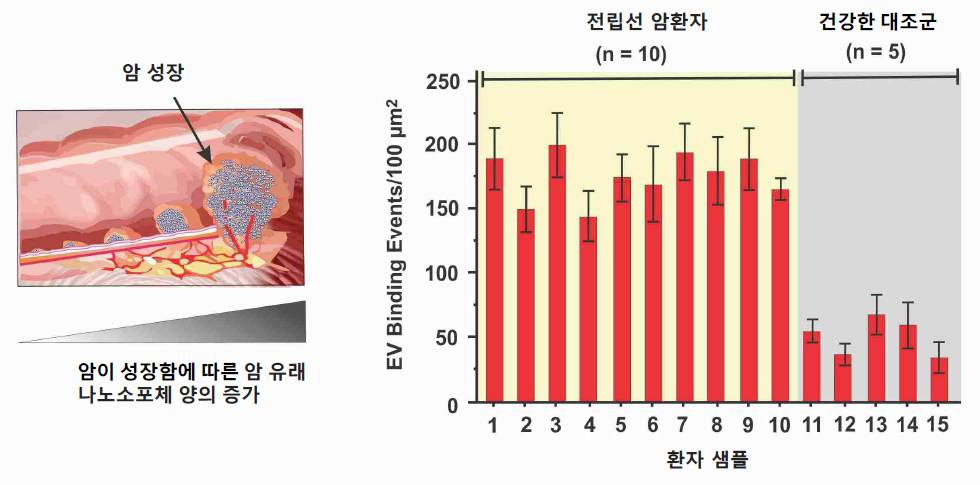 (왼쪽) 암세포가 커질수록 혈액 내 나노소포체 수가 증가함을 보여주는 모식도. (오른쪽) 혈소판 칩을 활용한 전립선 암 환자(표본 10개) 및 건강한 대조군(표본 5개) 유래 혈장 샘플의 플라즈모닉 반응 비교.