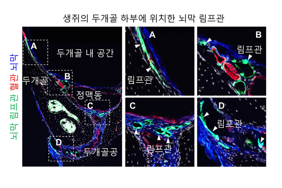 그림 2. 뇌척수액과 가깝게 위치한 뇌 하부 뇌막 림프관