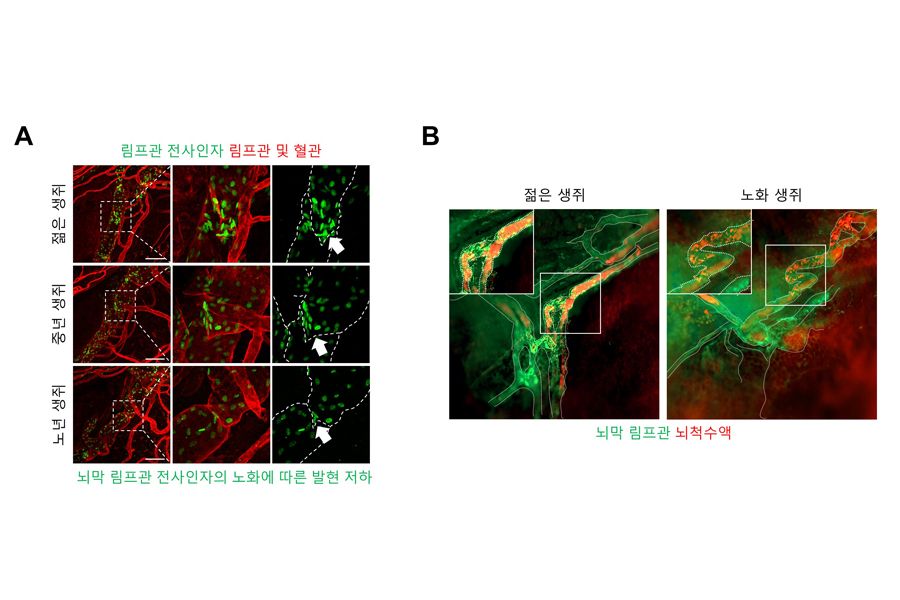 노화에 따른 뇌 하부 뇌막 림프관의 기능 저하를 보여주는 형광 현미경 이미지. 노화 생쥐 뇌막 림프관의 구조가 망가져 뇌 노폐물을 담은 뇌척수액 배출이 원활하지 않음을 확인할 수 있다.