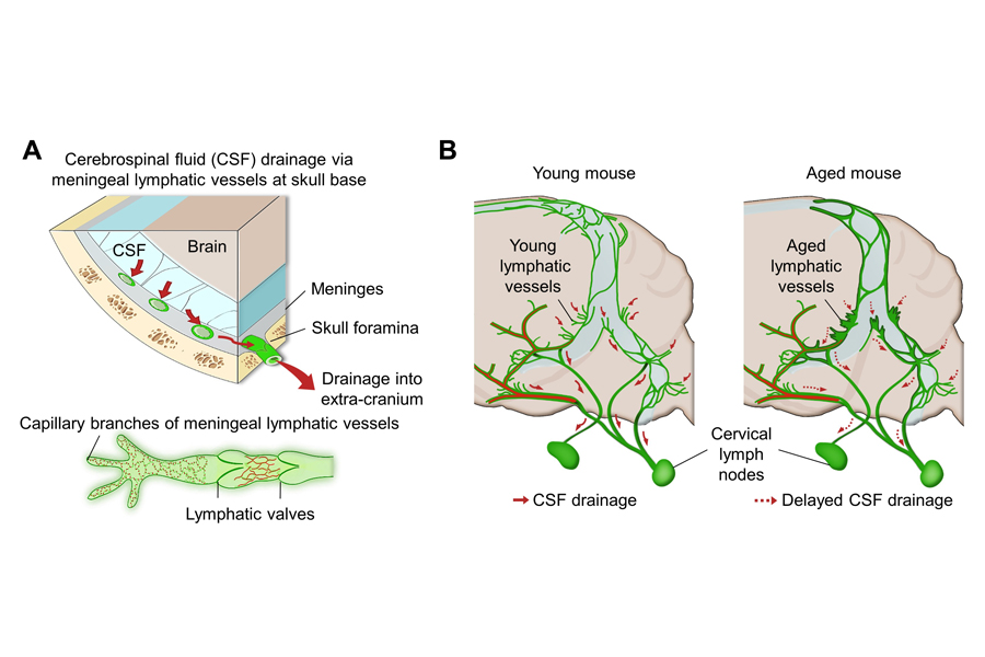 Figure 1 Schematic images of location and features of meningeal lymphatic vessels and their changes associated with ageing