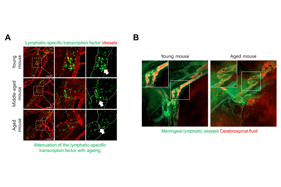 Figure 2. Structural and functional impairment of basal meningeal lymphatic vessels with ageing.