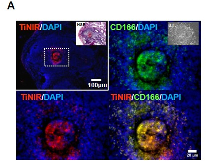 종양이 유도된 생쥐의 폐에서 타이니어가 종양근원세포를 붉은색으로 물들였다 (사진 : IBS)
