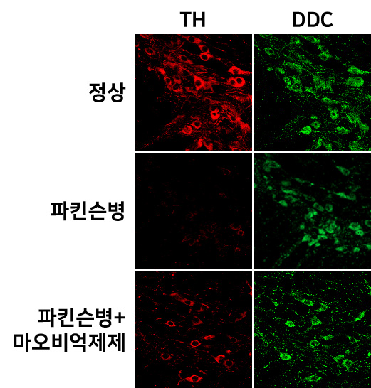그림 2. 파킨슨병 쥐에서 발견되는 도파민 신경세포