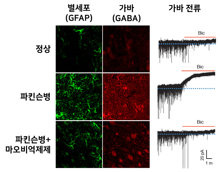 그림 3. 파킨슨병 쥐에서 발견되는 반응성 별세포의 가바(GABA) 과다 분비