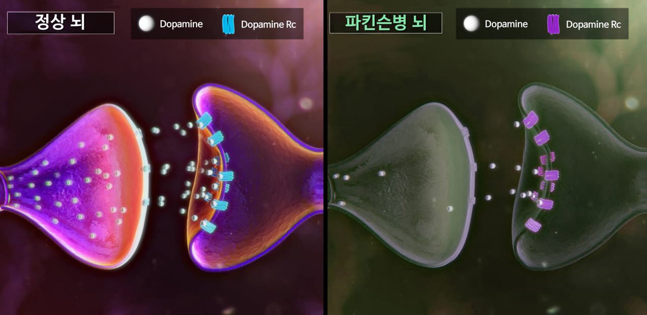 도파민은 운동에 꼭 필요한 신경전달물질이다. 파킨슨병 환자의 경우, 도파민 신경세포가 도파민 생성 기능을 잘 하지 못하기 때문에 운동기능에 이상이 생긴다.