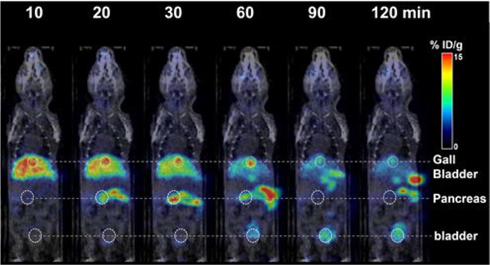 PiF를 주입한 뒤 촬영한 PET/CT 이미지.