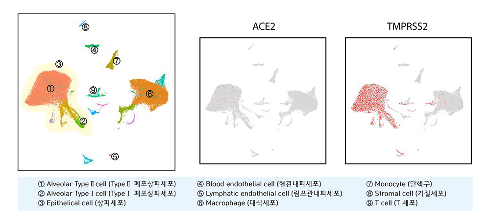 양명진 연구원은 공개된 GSE122960 유전정보에 근거해 성인 8명에게서 채취한 4만1082개 폐세포의 단일 세포 유전자발현을 분석했다. 2019-nCoV가 인지하는 효소 중 하나인 ACE2(가운데 그림)는 TypeⅡ 폐포 세포에서만 특이적으로 발현되는 반면, 바이러스 단백질을 가공하여 세포 내 침입을 가속화하는 효소인 TMPRSS2(오른쪽 그림)는 폐 상피세포 전반에 걸쳐 높게 발현되는 양상을 보인다.