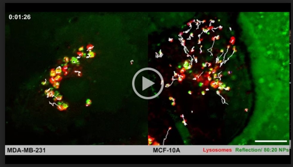 Video 1: Time-lapse microscopy reveals the movements of lysosomes containing mixed-charge nanoparticle cargoes. Lysosomes in cancer cells (left) are slowed down and cluster around the cell center as compared to the directional trajectories of lysosomes in healthy cells (right).