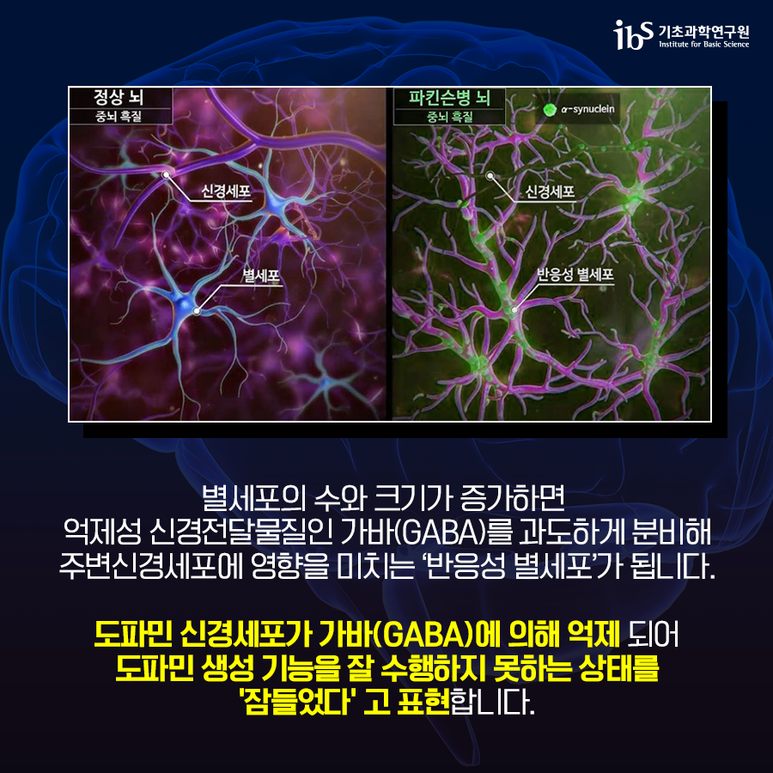 [기초과학연구원] 미래에는 파킨슨병 초기에 치료할 수도! 잠들기만해도 파킨슨병을 유발하는 도파민 신경세포! 이미지5로서 자세한 내용은 하단에 위치해 있습니다.