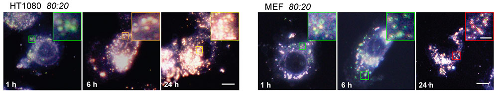 그림 2. 암시야현미경으로 관찰한 세포 내에서 나노입자 이미지