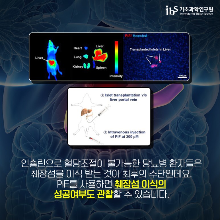 [기초과학연구원] 당뇨병 정밀 진단 위한 형광물질 개발! 이미지6로서 자세한 내용은 하단에 위치해 있습니다.