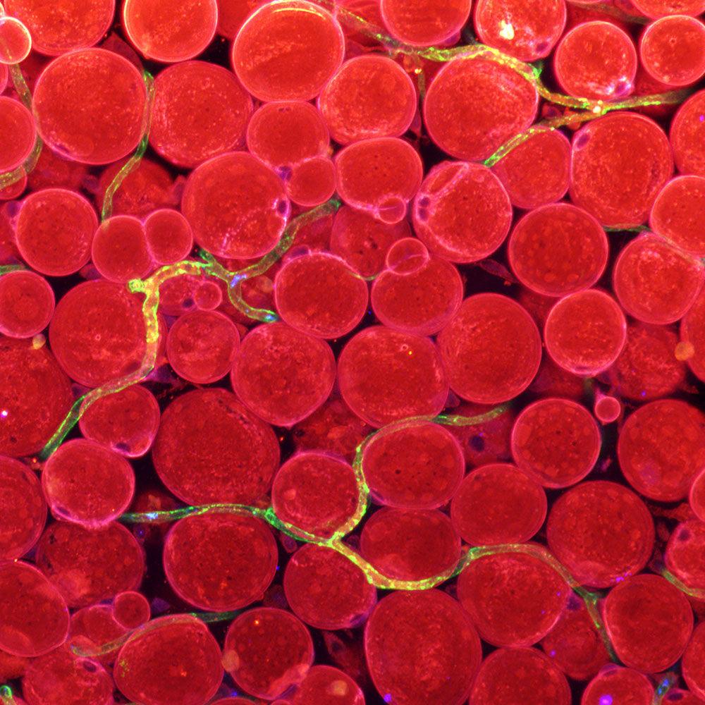 Figure 1 Expression of fatty acid transporters in blood vessels.