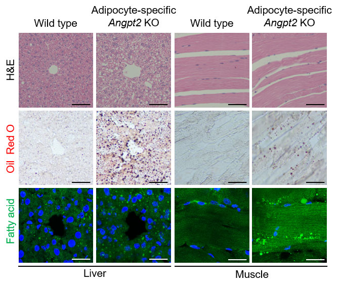 Figure 3 Depletion of Angiopoietin-2 from fat cells drives fat accumulation in other fat depots and abdominal organs.
