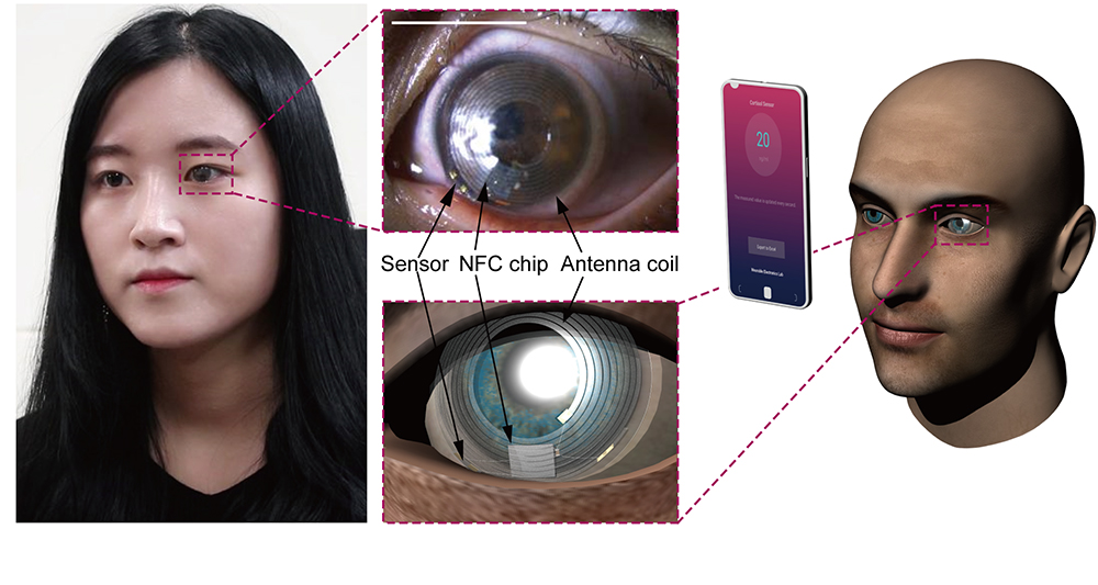 그림 2. 스트레스 호르몬 측정용 스마트 콘택트렌즈를 실제 착용한 모습