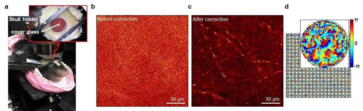 [Figure 3-1] Label-free reflectance imaging of myelinated axons in a mouse brain through the intact skull