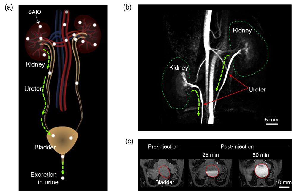 Figure 3. Excretion of SAIO