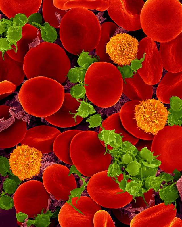 혈액은 독특한 기능과 특성을 가진 세포들의 집합체다. 사진 속 붉은 원은 적혈구, 주황색 구는 T세포, 초록색은 혈소판을 나타낸다.(출처: Pixabay)